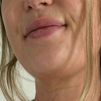 alexandramiddle Nahé