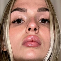 cassidyraw Nahé