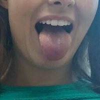monteroo Nahé